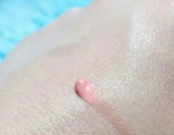 Biodermal Sun Lipbalm SPF25 - Tube 12 Ml - Natural Pink - Lippenbalsem 7 Biodermal Sun Lipbalm SPF25 - Tube 12 Ml - Natural Pink - Lippenbalsem -Modecosmetica 1200x927 1